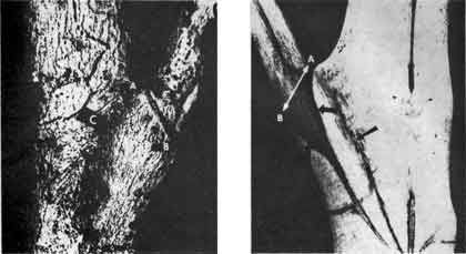 Photos and diagrams of branch growth.